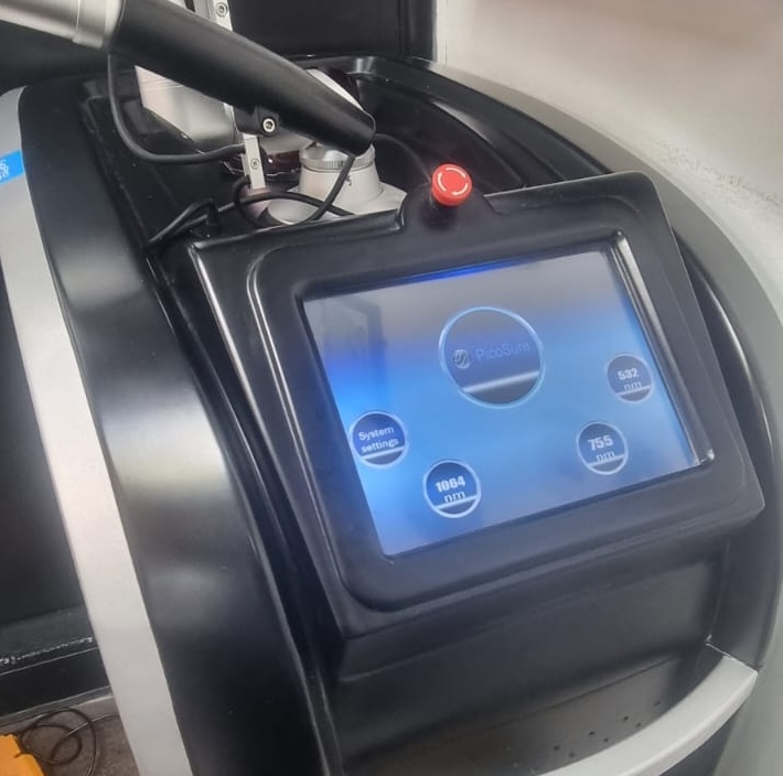 image of laser tattoo removal machine